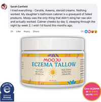 Baby Eczema Beef Tallow Balm